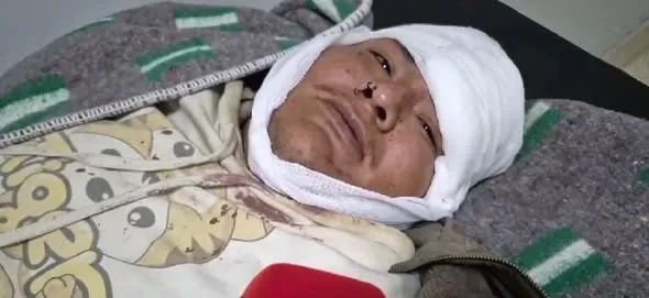 Sobreviviente denuncia negligencia en accidente de flota Narváez.