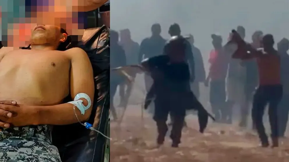 Defensoría reporta 33 heridos en San Julián y confirma que cuatro policías tenían impactos de bala Defensoría reporta 33 heridos en San Julián y confirma que cuatro policías tenían impactos de bala
